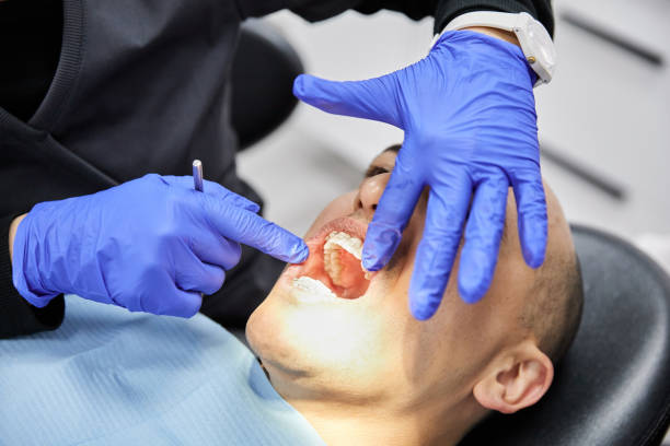 Best Emergency Root Canal Treatment in North Terre Haute, IN